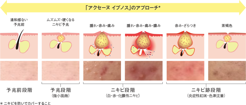 【イプノス】初回限定スペシャルキット 罪悪感無しニキビメイク